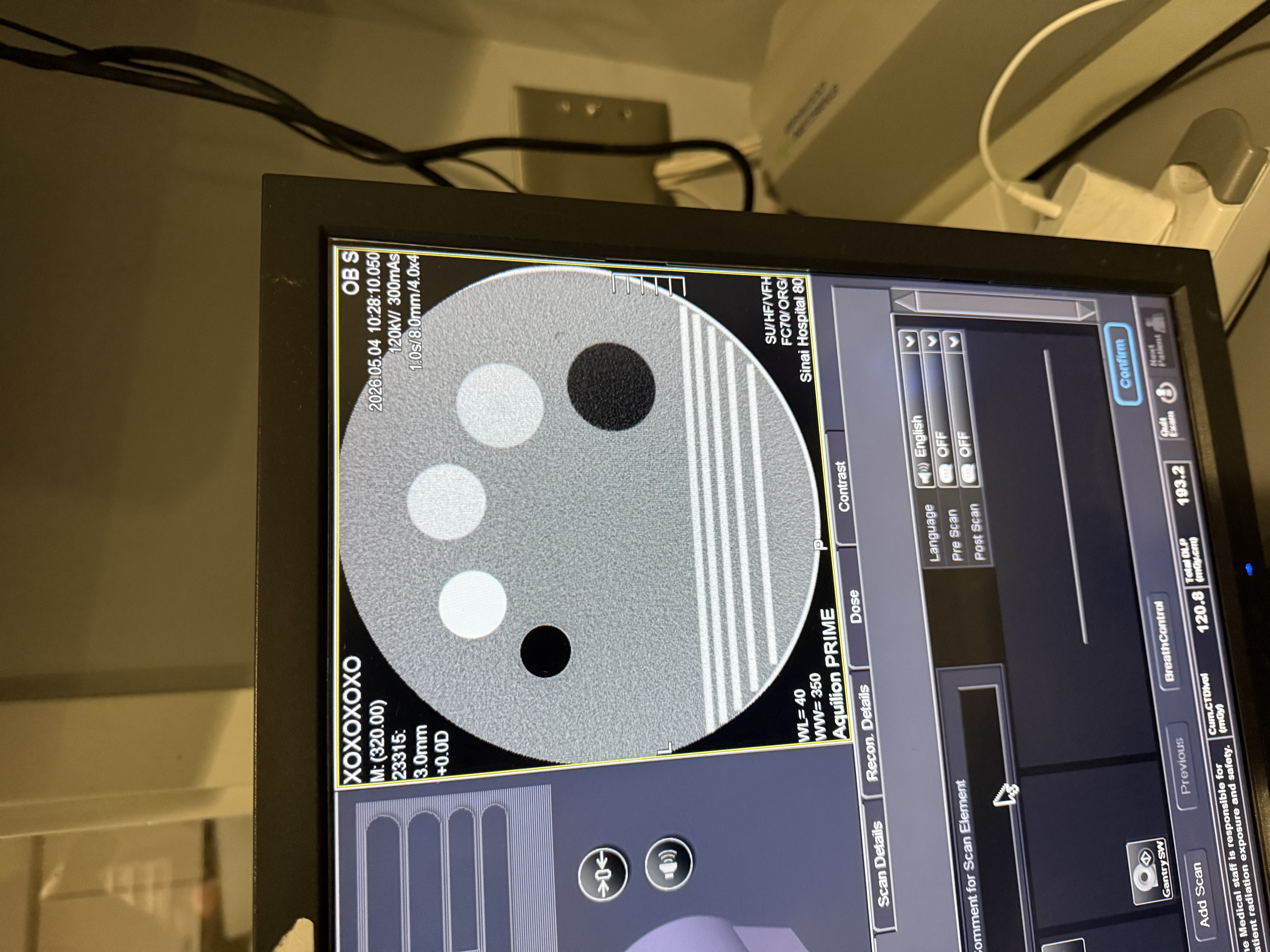 2016 Toshiba Aquilion Prime S 80 CT QA Scan
